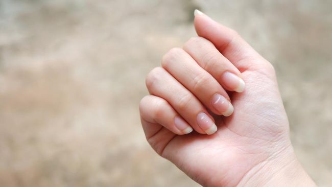 Begini Cara Mengenali Kuku Tidak Sehat, Bisa Jadi Sinyal Penyakit