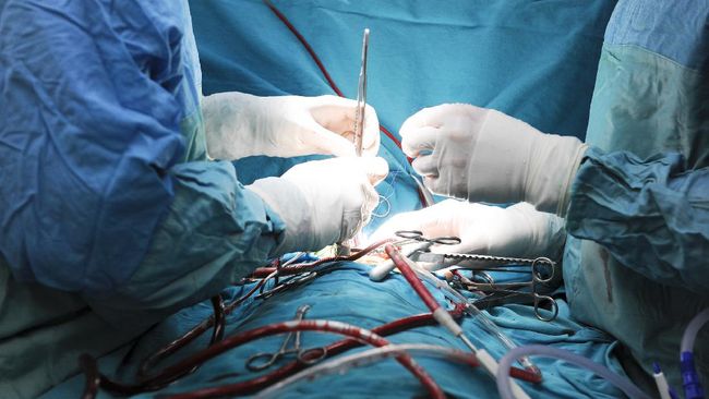 120 Benda Asing Ditemukan di Perut Pria, Termasuk Pisau dan Gunting