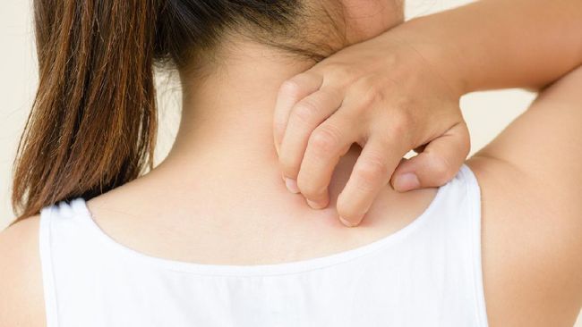 5 Tanda Penyakit Ginjal di Kulit, Kenali Sebelum Makin Parah