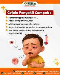Diskes Pekanbaru Himbau Warga Periksa Kesehatan Jika Alami Gejala Campak